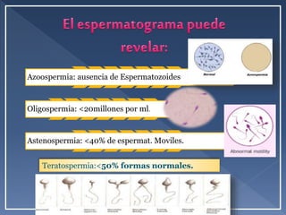 Azoospermia: ausencia de Espermatozoides
Oligospermia: <20millones por ml.
Astenospermia: <40% de espermat. Moviles.
Teratospermia:<50% formas normales.
 