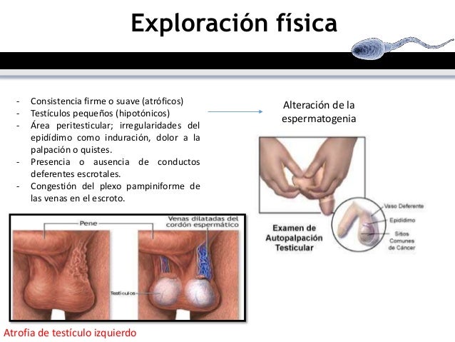 La operación de los aumentos del miembro
