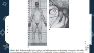 22
Pruebas Complementarias
• Estudios Cromosómicos
• Análisis de Orina
• Cultivo de Semen
 