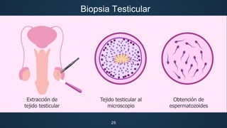 25
Biopsia Testicular
 