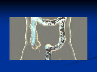 Infertilidad, una opción natural