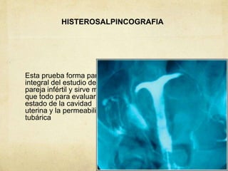 HISTEROSALPINCOGRAFIA
Esta prueba forma parte
integral del estudio de la
pareja infértil y sirve más
que todo para evaluar el
estado de la cavidad
uterina y la permeabilidad
tubárica
 