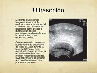 Ultrasonido
Mediante el ultrasonido
transvaginal es posible
evaluar las características del
cuello del útero y descartar
patologías como pólipos o
miomas que podrían
representar un obstáculo para
la penetración de los
espermatozoides.
Con este método también se
puede valorar la producción
de moco cervical durante la
fase ovulatoria del ciclo
menstrual, porque se observa
en el canal cervical una
imagen hipoecoica alargada,
cuyo grosor varía de acuerdo
a la cantidad de moco que
produce el paciente.
 