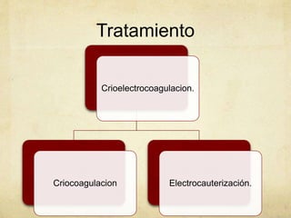 Tratamiento
Crioelectrocoagulacion.
Criocoagulacion Electrocauterización.
 