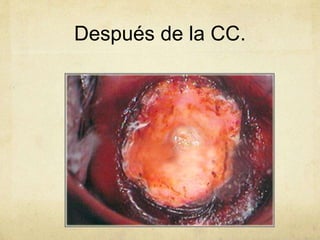 Después de la CC.
 