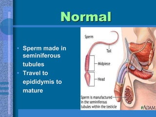 NormalSperm made in seminiferous	tubulesTravel to 	epididymis to 	mature