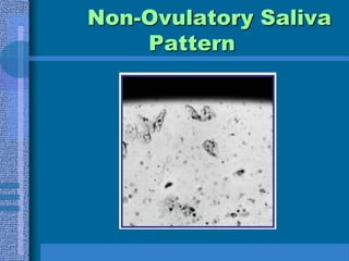 Serum ProgesteroneProgesterone starts rising with the LH surgedrawn between day 21-24Mid-luteal phase>10 ng/ml suggests ovulation