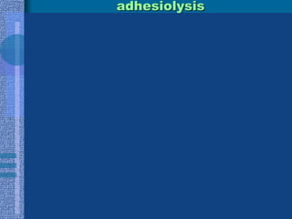 		HSG: Tubal Infertility