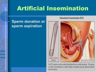 Maximum dose is usually 150mg50mg dose - 50% ovulate100mg -25% more ovulate150mg lower numbers of ovulationNo changes in birth defects If no pregnancy in 6 months refer for advanced therapies7% risk of twins   0.3% triplets