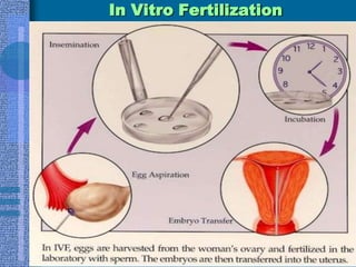 Anatomic AbnormalitiesSurgical treatmentsLysis of adhesionsSeptoplastyTuboplastyMyomectomySurgery may be performed laparoscopicallyhysteroscopicallyIf the fallopian tubes are beyond repair one must consider in vitro fertilization