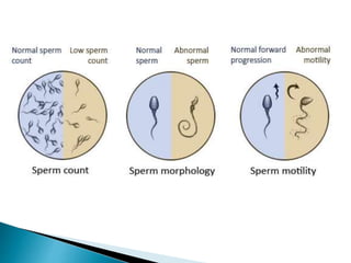 Subfertility (Infertility) | PPTX