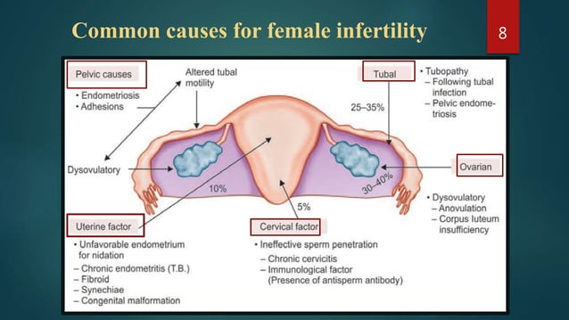 medical management of infertility,think before surgery!!!! | PPTX ...