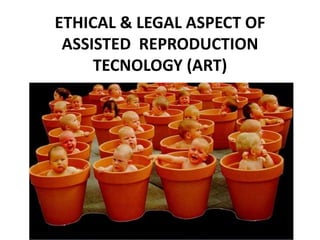 ETHICAL & LEGAL ASPECT OF
ASSISTED REPRODUCTION
TECNOLOGY (ART)
 