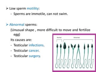  Low sperm motility:
- Sperms are immotile, can not swim.
 Abnormal sperms:
(Unusual shape , more difficult to move and fertilize
egg)
Its causes are:
- Testicular infections.
- Testicular cancer.
- Testicular surgery.
 