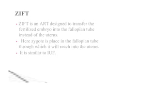 Zift How Insert infertility-190503091837.pdf for gynaecology | PDF