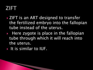  ZIFT is an ART designed to transfer
the fertilized embryo into the fallopian
tube instead of the uterus.
 Here zygote is place in the fallopian
tube through which it will reach into
the uterus.
 It is similar to IUF.
 