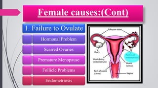 Female causes:(Cont)
1. Failure to Ovulate
Hormonal Problem
Scarred Ovaries
Premature Menopause
Follicle Problems
Endometriosis
 