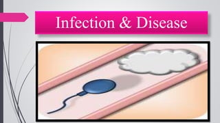 Infection & Disease
 