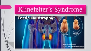 Klinefelter’s Syndrome
 