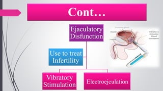Cont…
Ejaculatory
Disfunction
Vibratory
Stimulation Electroejculation
Use to treat
Infertility
 