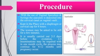 Procedure
 With the use of Vaginal Speculum &
Syringe the ejaculate is deposited into
the cervical canal or vaginal vault .
Kept in the Place with a diaphragm or
cervical cap for 8 hours.
The women may be asked to lie still
for a few minutes.
It is usually carried out 2-3 days
before the ovulation, 2-3
Inseminations may be required with
in one month cycle, the process may
continue for 6-12 months until
pregnancy occur.
 