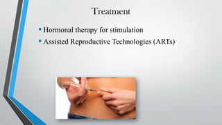 Treatment
•Hormonal therapy for stimulation
•Assisted Reproductive Technologies (ARTs)
 