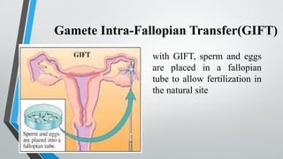 Gamete Intra-Fallopian Transfer(GIFT)
with GIFT, sperm and eggs
are placed in a fallopian
tube to allow fertilization in
the natural site
 