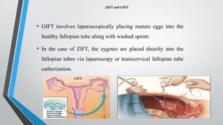 ZIFT and GIFT
• GIFT involves laparoscopically placing mature eggs into the
healthy fallopian tube along with washed sperm
• In the case of ZlFT, the zygotes are placed directly into the
fallopian tubes via laparoscopy or transcervical fallopian tube
catherization.
 