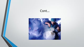 Cont…
 