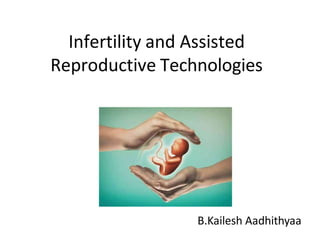 Infertility and Assisted
Reproductive Technologies
B.Kailesh Aadhithyaa
 