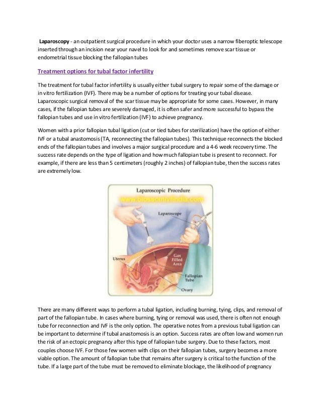Infertility and damaged fallopian tubes