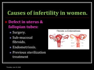 Causes of infertility in women.
 Defect in uterus &
fallopian tubes:
 Surgery.
 Sub-mucosal
fibroids.
 Endometriosis.
 Previous sterilization
treatment
Thursday, June 18, 2020
 