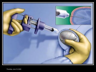 Thursday, June 18, 2020
 