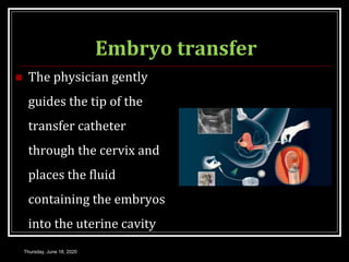 Embryo transfer
 The physician gently
guides the tip of the
transfer catheter
through the cervix and
places the fluid
containing the embryos
into the uterine cavity
Thursday, June 18, 2020
 