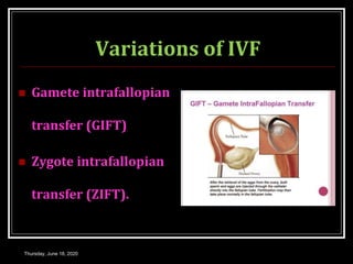 Variations of IVF
 Gamete intrafallopian
transfer (GIFT)
 Zygote intrafallopian
transfer (ZIFT).
Thursday, June 18, 2020
 