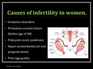Causes of infertility in women.
 Ovulation disorders:
 Premature ovarian failure
(before age of 40)
 Polycystic ovary syndrome.
 Hyper-prolactinemia (in non
pregnant state)
 Poor egg quality.
Thursday, June 18, 2020
 
