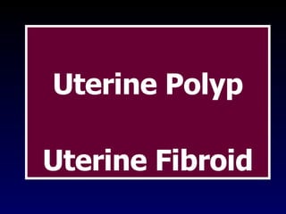 Uterine Polyp Uterine Fibroid 