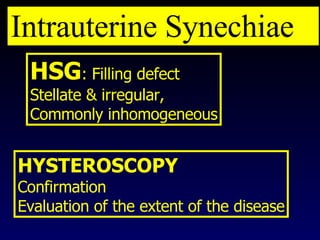 HSG : Filling defect Stellate & irregular, Commonly inhomogeneous HYSTEROSCOPY Confirmation Evaluation of the extent of the disease Intrauterine Synechiae 