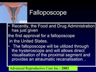 Falloposcope Recently, the Food and Drug Administration has just given  the first approval for a falloposcope in the United States. The falloposcope will be utilized through the hysteroscope and will allows direct visualisation of the proximal segment and provides an atraumatic recanalisation .  .  Advanced Reproductive Care Inc  : 2002 