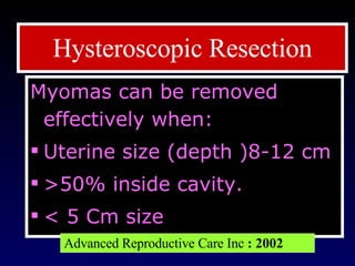 Myomas can be removed effectively when: Uterine size (depth )8-12 cm  >50% inside cavity. < 5 Cm size  Hysteroscopic Resection Advanced Reproductive Care Inc  : 2002 