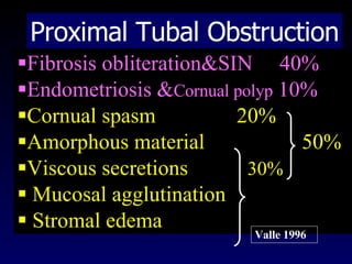 Proximal Tubal Obstruction Fibrosis obliteration&SIN  40% Endometriosis & Cornual polyp  10% Cornual spasm  20% Amorphous material  50% Viscous secretions  30% Mucosal agglutination Stromal edema Valle 1996 