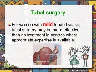 Tubal surgery 
For women with mild tubal disease, 
tubal surgery may be more effective 
than no treatment in centres where 
appropriate expertise is available. 
 