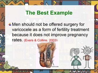 The Best Example 
Men should not be offered surgery for 
varicocele as a form of fertility treatment 
because it does not improve pregnancy 
rates. (Evers & Collins, 2003) 
 