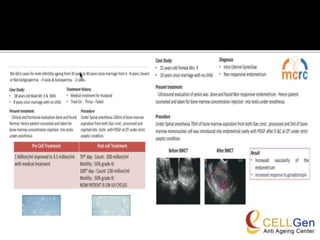 Stem Cell For Infertility Treatment | PPTX