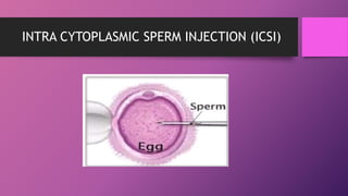 INTRA CYTOPLASMIC SPERM INJECTION (ICSI)
 