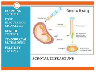 SCROTAL ULTRASOUND
HORMONE
TESTING
POST
EJACULATION
URINALYSIS
GENETIC
TESTING
TRANSDUCTAL
ULTRASOUND
FERTILITY
TESTING
 
