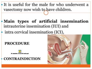  It is useful for the male for who underwent a
vasectomy now wish to have children.
 Main types of artificial insemination
intrauterine insemination (IUI) and
 intra cervical insemination (ICI),
PROCEDURE
 CONTRAINDICTION
 