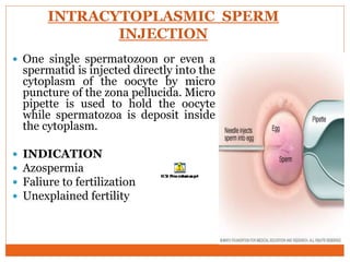 INTRACYTOPLASMIC SPERM
INJECTION
 One single spermatozoon or even a
spermatid is injected directly into the
cytoplasm of the oocyte by micro
puncture of the zona pellucida. Micro
pipette is used to hold the oocyte
while spermatozoa is deposit inside
the cytoplasm.
 INDICATION
 Azospermia
 Faliure to fertilization
 Unexplained fertility
 