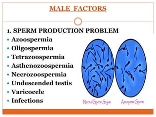 MALE FACTORS
1. SPERM PRODUCTION PROBLEM
 Azoospermia
 Oligospermia
 Tetrazoospermia
 Asthenozoospermia
 Necrozoospermia
 Undescended testis
 Varicocele
 Infections
 