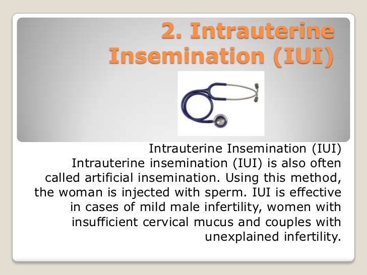 Parlodel And Infertility